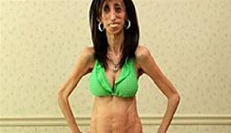 5 Skinniest People in the World - Answers Africa