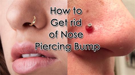 How to Get Rid of Nose Piercing Bump | Nose Piercing