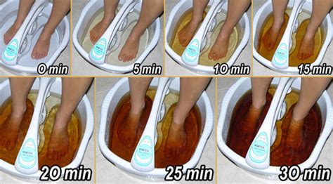 Detox Foot Spa - Ionic Detoxification To Cleanse & Remove Toxins