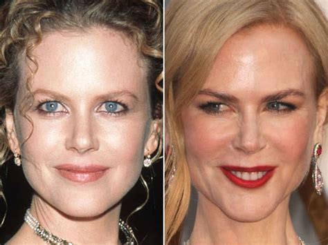 Nicole Kidman Before and After - The Skincare Edit