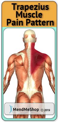 Trapezius Strain