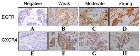 EGFR expression is associated with cytoplasmic staining of CXCR4 and ...