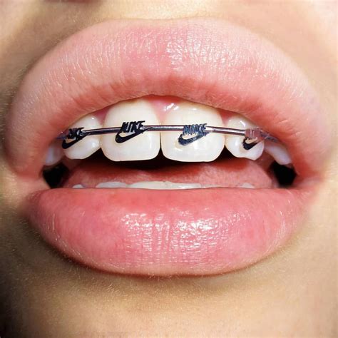 cute braces colors for fall - Holding Weblogs Photographs