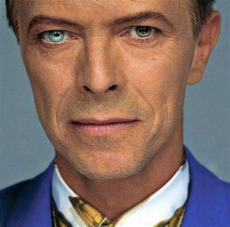 David Bowie and his heterochromia (eyes of different colours) | David ...