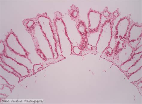 Sponge cross section, 100x | Marc Perkins Photography