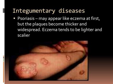 PPT - Selected Integumentary System Diseases & Conditions PowerPoint ...