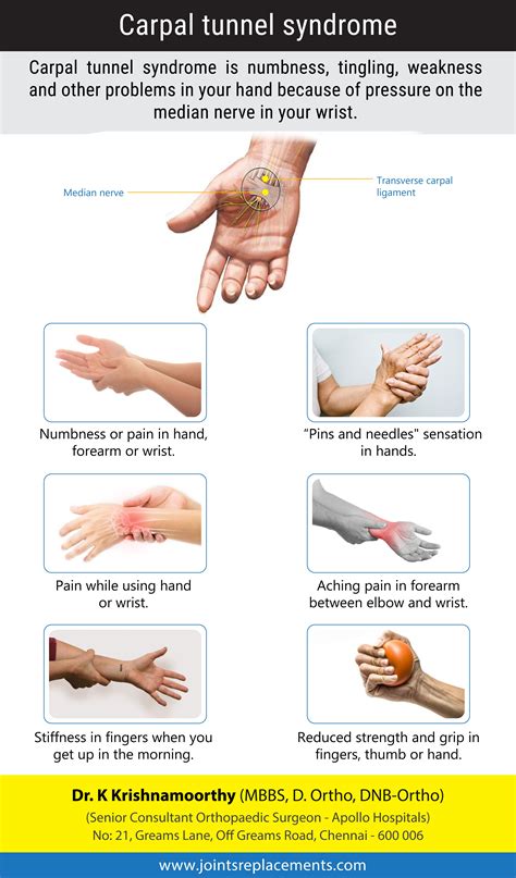 B6 For Carpal Tunnel | Carpal Tunel: Healing by Stretching | Carpal ...