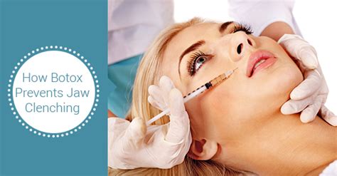 How Botox Help Stop Clenching Your Jaw | City Oasis Dental