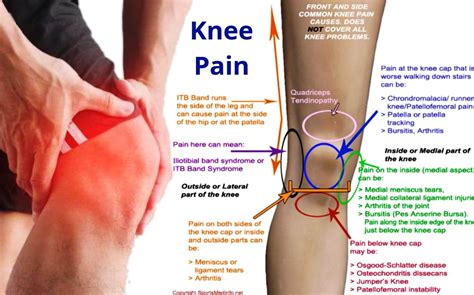 Knee pain homeopathic treatment right knee left knee by dr makkar – Artofit