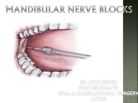 Mandibular nerve blocks techniques