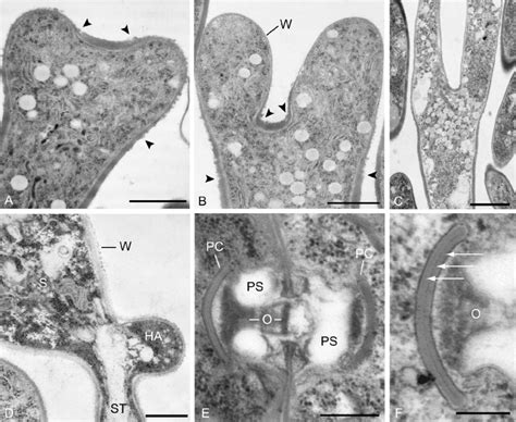 Ultrastructure of basidia, basidiospore and septa of D. primogenitus ...