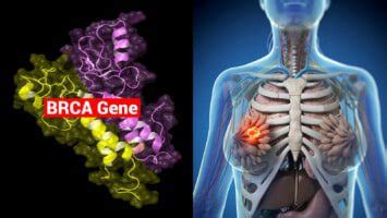 Researchers Explain How the BRCA Gene Increases Breast Cancer Risk