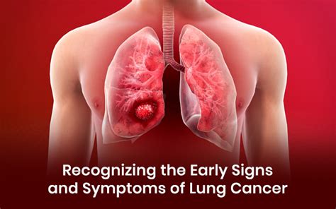 Recognizing the Early Signs and Symptoms of Lung Cancer