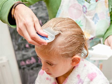 Head Lice Treatments Information That You Need to Know – Health promotion