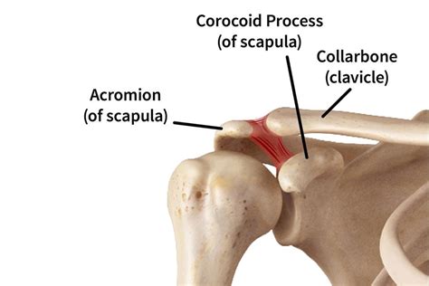 Clavicle Fracture Treatment and Healing - Fracture Healing