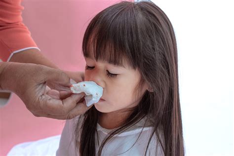 How to Stop Nose Bleeding for Children?