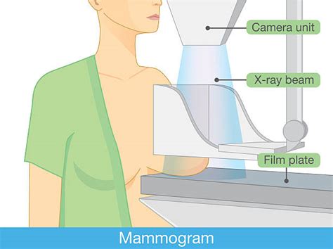 Royalty Free Mammogram Clip Art, Vector Images & Illustrations - iStock