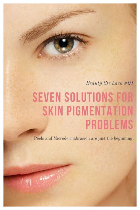 Skin pigmentation problems are common and luckily there are easy ...