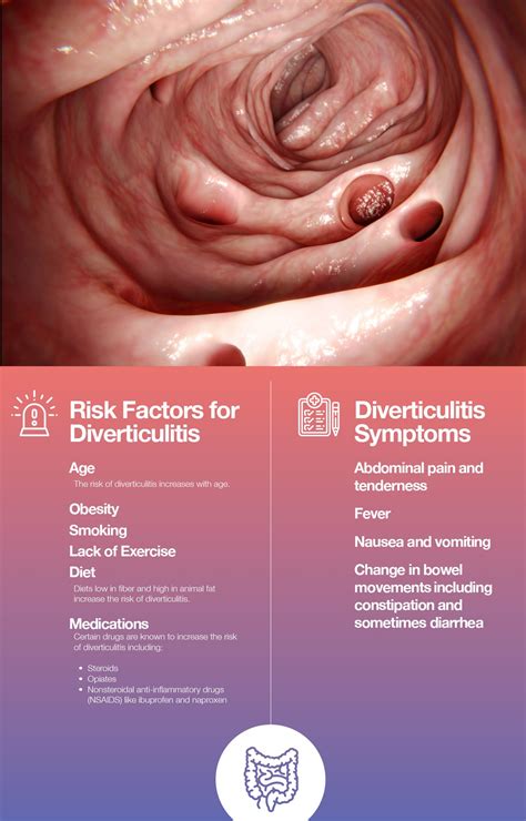 Understanding Diverticulitis Causes Symptoms And Treatment Options ...