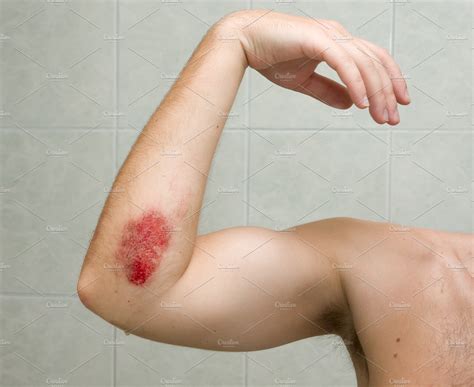 Scraped elbow | Health & Medical Stock Photos ~ Creative Market