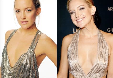 Breast Augmentation Before And After: Celebrity Edition — Atlantic ...