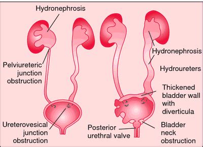 20 - Urogenital Anatomy Flashcards | Quizlet