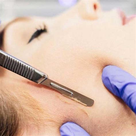 Dermaplaning Facial in NYC, Miami, Boston & Dallas – Skin Spa New York