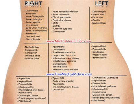 Pin on Medical Mnemonics