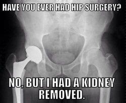 Funny xray Memes in 2020 | Rad tech humor, Radiology humor, Student humor