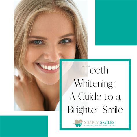 Teeth Whitening: A Guide to a Brighter Smile – Simply Smiles Miami