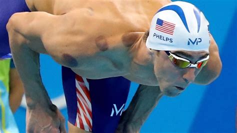 Placebo Effect Boosts Olympian Performance | Cupping treatment, Michael ...