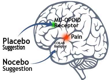 What Is Placebo Effect? (Working Psychology) - JournalHow