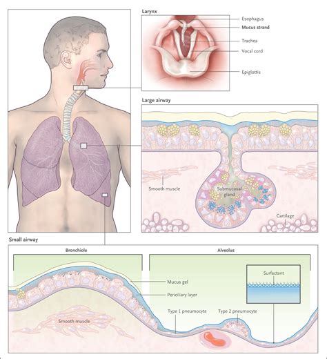 Airway Mucus Function and Dysfunction | NEJM