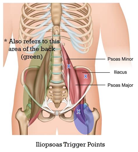 Acupuncture for Psoas Trigger Points — Morningside Acupuncture NYC