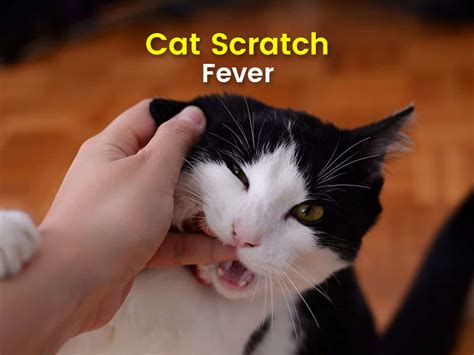 All You Need To Know About Cat Scratch Fever: Symptoms, Causes ...