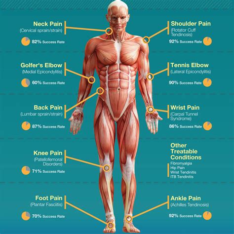 Graston Technique® - Coastal Sports and Wellness