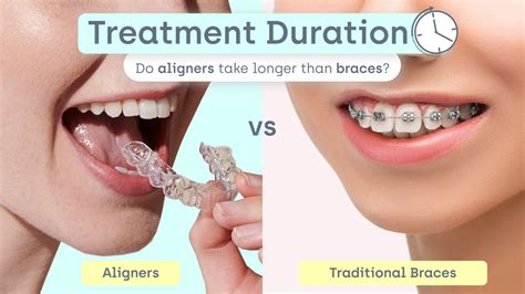 How long do braces take vs. Straight Teeth Direct™ aligners?