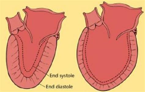 S4 Heart Sound Topic Review | Learn the Heart