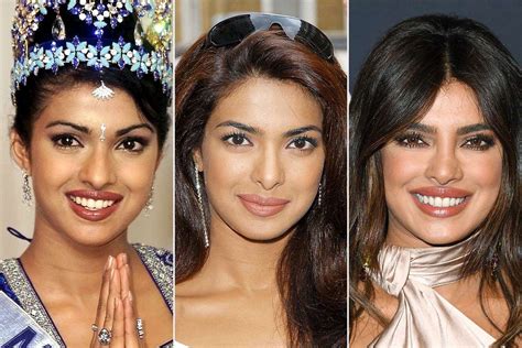 Priyanka Chopra Opens Up About Getting a Botched Nose Surgery