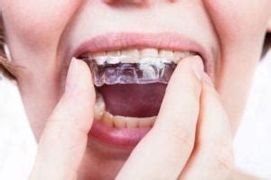 NTI Night Guard: Cost, Problems, Side Effects, and Comparison - Dentaly.org