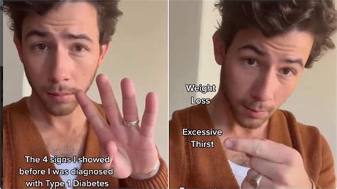 Nick Jonas shares 4 symptoms he experienced before getting diagnosed ...