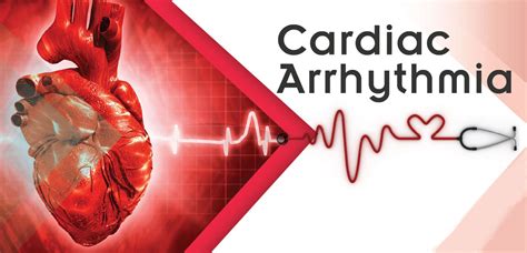 What Causes Sudden Cardiac Arrhythmia - BEST HOME DESIGN IDEAS