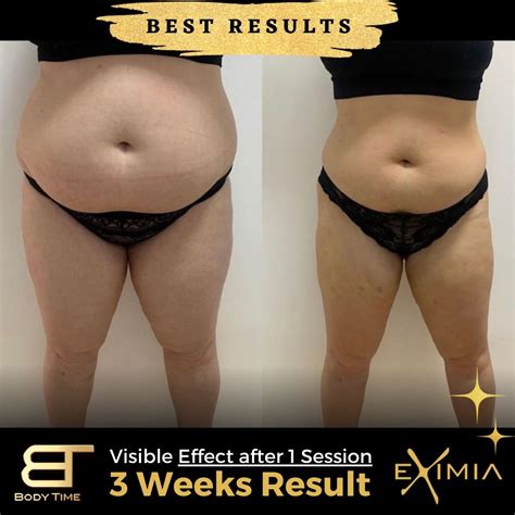 Best Results Eximia Dubai | BODY TIME DUBAI 🇦🇪