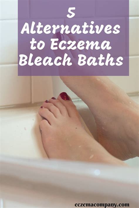 5 Alternatives to Eczema Bleach Baths | Bleach bath, Bleach bath for ...