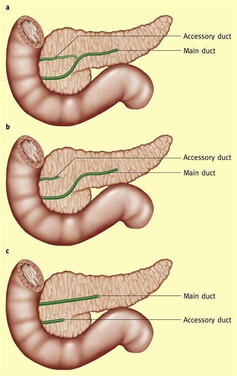 Anatomy of the pancreas and the spleen - Surgery - Oxford International ...