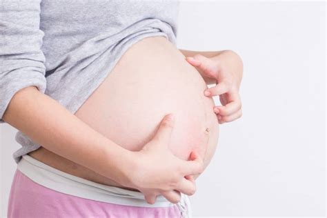 PUPPP Pregnancy Rash: Causes and Treatment