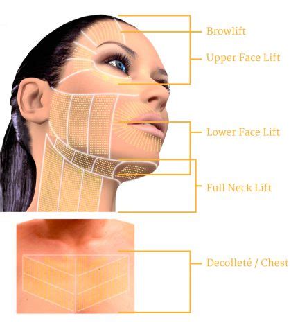 Ultherapy Face Neck Chin Jowls Tightening Near Me NJ | Price Cost