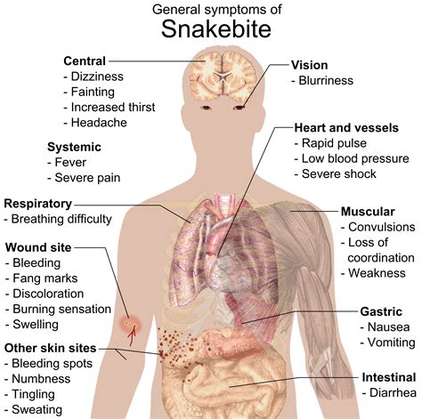 File:Snake bite symptoms.png