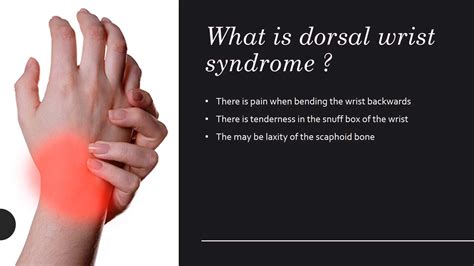 Dorsal Wrist Syndrome Diagnosis and Treatment - Dr Anzarut Plastic Surgery