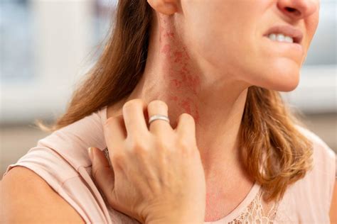 Allergic Reactions and Skin Rash - Aesthetic & Dermatology Center